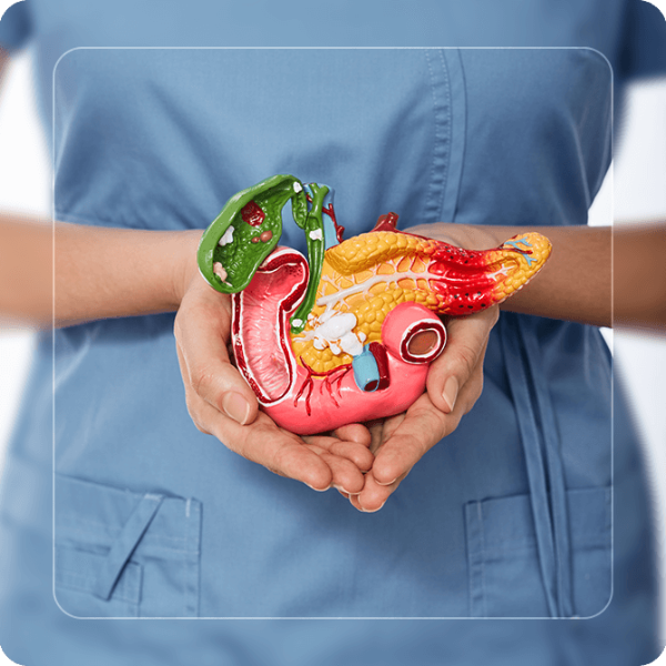 Pancreatic duct stones and strictures